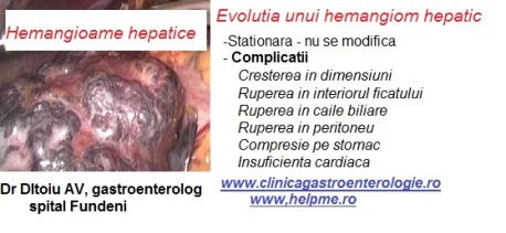 hemangiom-hepatic-evolutie